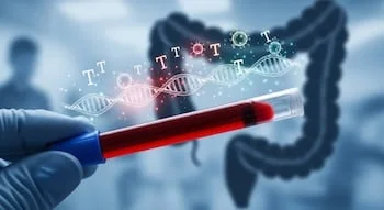 Una mano enguantada sostiene un tubo de ensayo con sangre. Cadenas de ADN y receptores de células T brillan sobre la muestra. Al fondo, una silueta de colon.