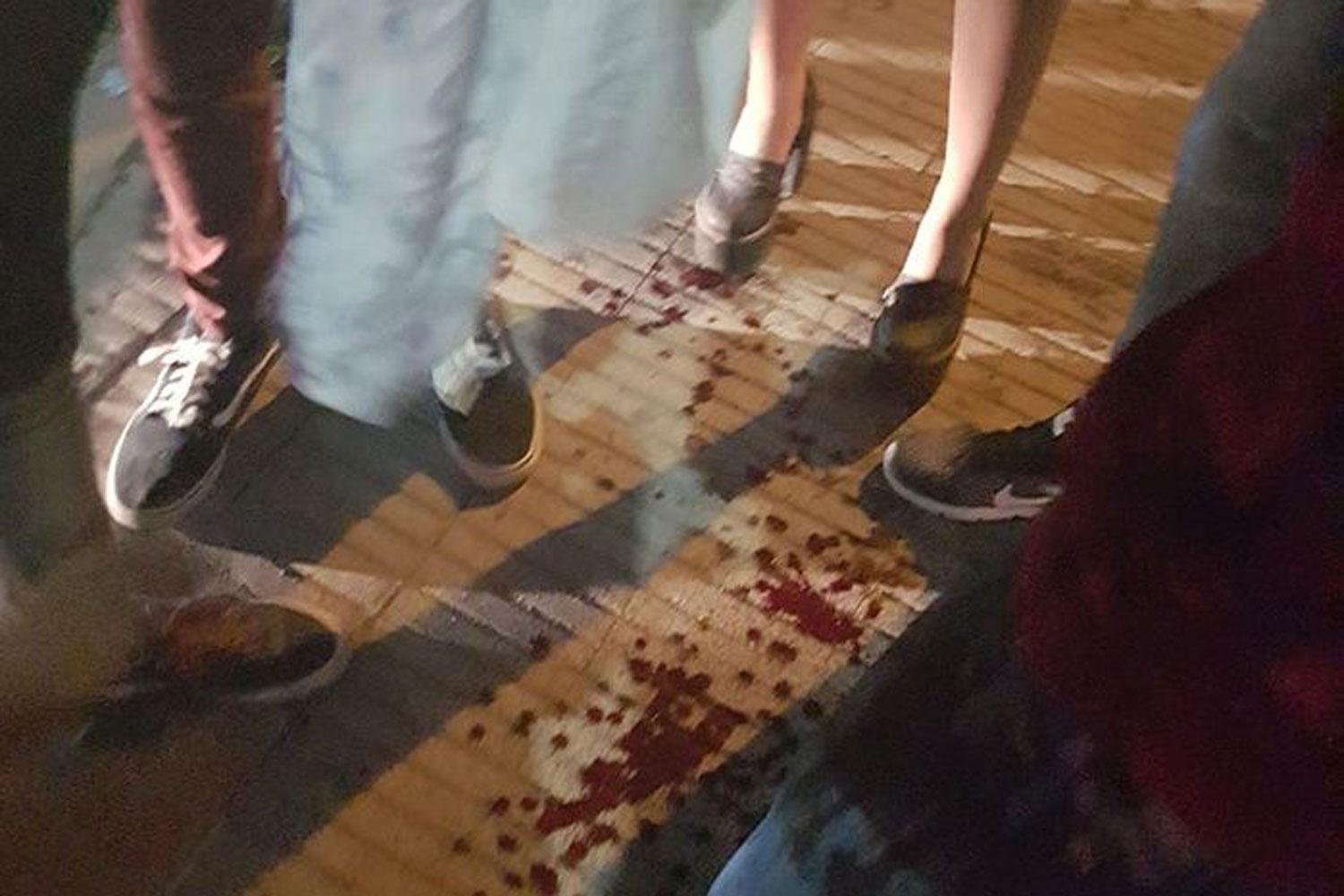 Tucumán: agredió a machetazos a jóvenes que salían de bailar.