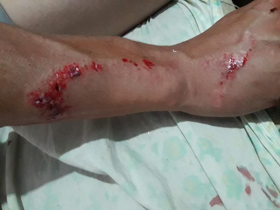 Denunció salvaje ataque contra dos ancianos