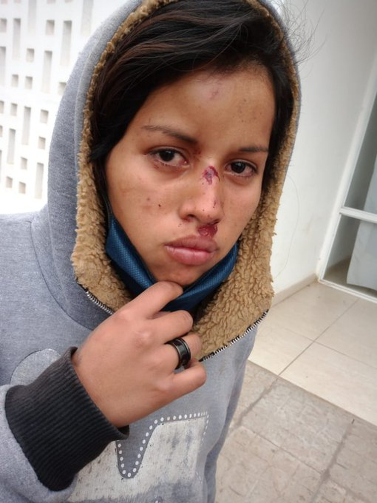 Chaco: integrantes de la comunidad Qom denunciaron torturas y abuso sexual