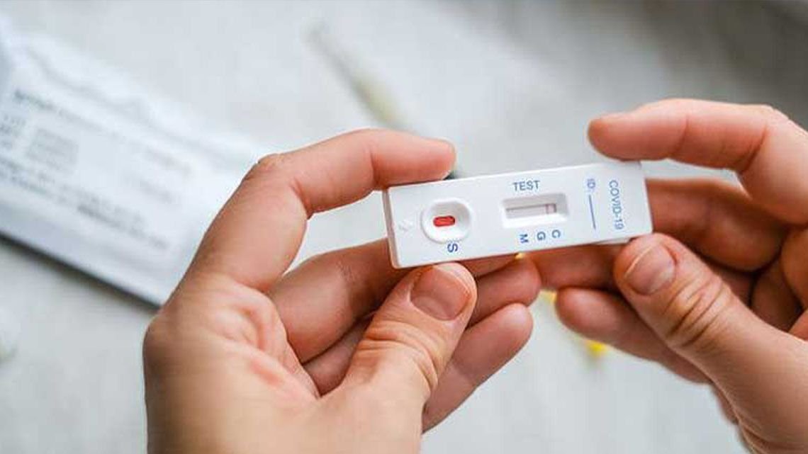 Los primeros autotest de coronavirus saldrán 1.560 pesos