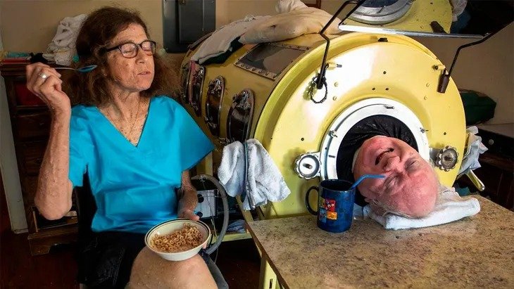 Murió Paul Alexander, el hombre que vivía en un pulmón de acero
