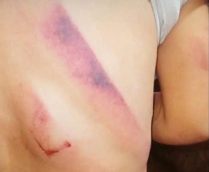 Se abstuvo de declarar la bestia que golpeó brutalmente a la pequeña de 4 años