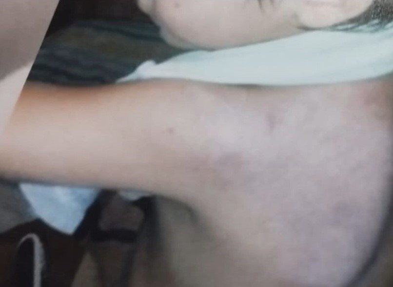 El desgarrador testimonio de un niño de 12 años brutamente golpeado por su madre