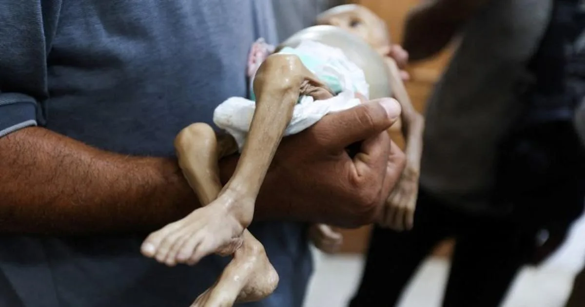 Alerta internacional: Hambruna en Gaza desencadena crisis sin precedentes