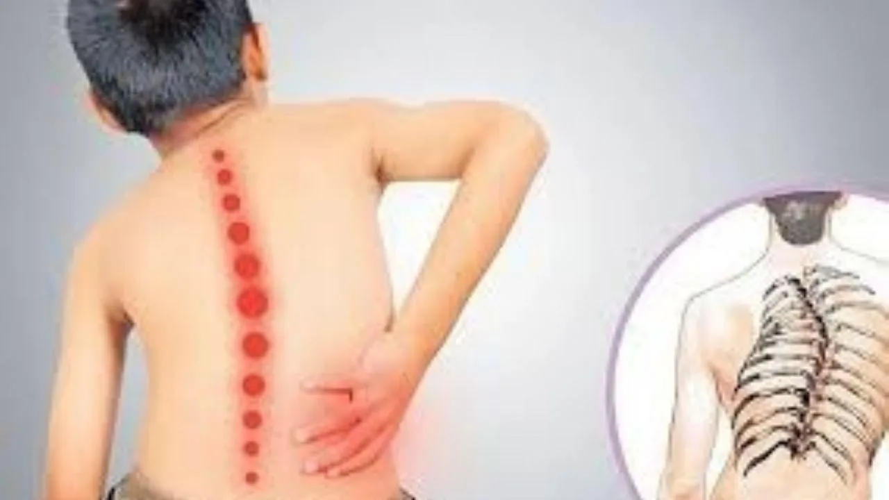 Avances y tratamientos para la Atrofia Muscular Espinal: claves y novedades